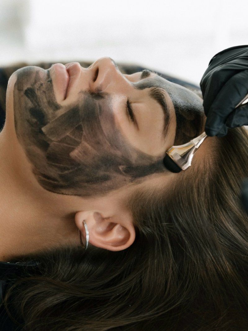 Klientė su anglies kauke carbon peeling procedūros metu